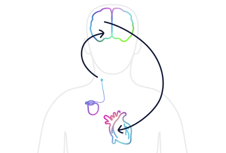 barostim anatomy animation